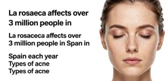 La acne rosácea afecta a más de 3 millones de personas en España cada año